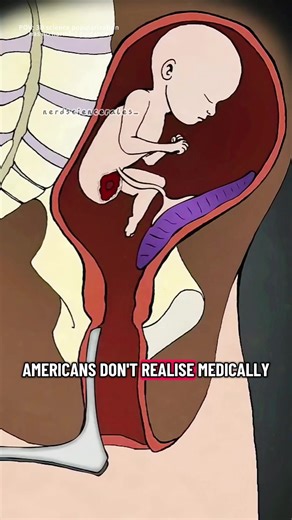 What Happens During An Abbortion? (3D Animation) #abortion #abortionprocess #birth #dilationandcurettage #abortionbaby