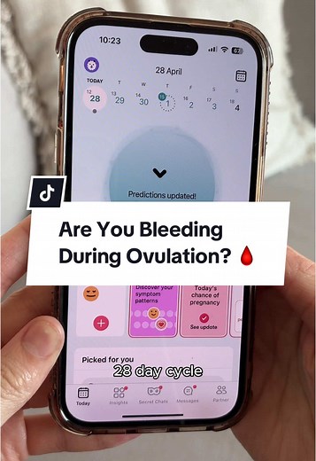 Understanding Ovulation Bleeding: Causes and Insights