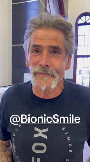 6K views · 45 reactions | Bionic Smile on Reels | Facebook