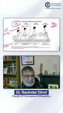 NEET SS | Musculoskeleton Pathology in Cerebral Palsy by Dr. Ravinder Dimri
