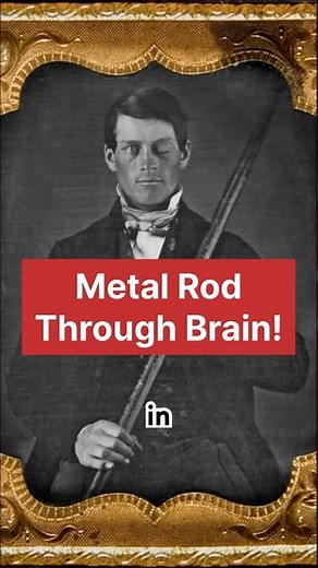 The Man Who Survived a Metal Rod Through His Brain
