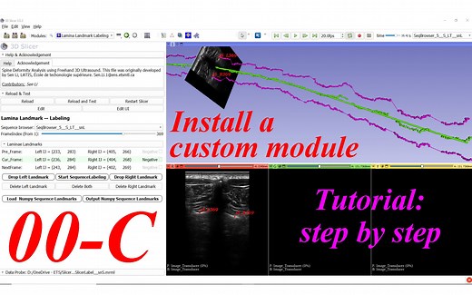How to install a custom extension module- #00-C. 3D Slicer Tutorial step by step
