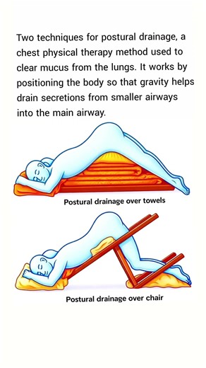 techniques for postural drainage, a chest physical therapy method used to clear mucus from the lung