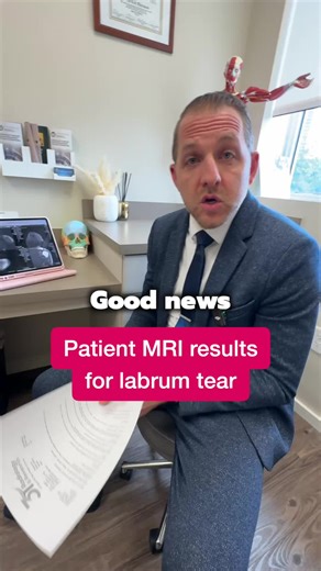 We just got the MRI results back for our patient with a torn labrum, and the good news is that the tear is the only issue—no other complications! A torn labrum is an injury to the ring of cartilage in the shoulder that helps stabilize the joint, often caused by trauma or overuse. While it can be painful and limit movement, with the right treatment plan, recovery is very achievable. We’re ready to move forward and get our patient back to full strength! #MRIresults #labrumtear #shoulderinjury #rec