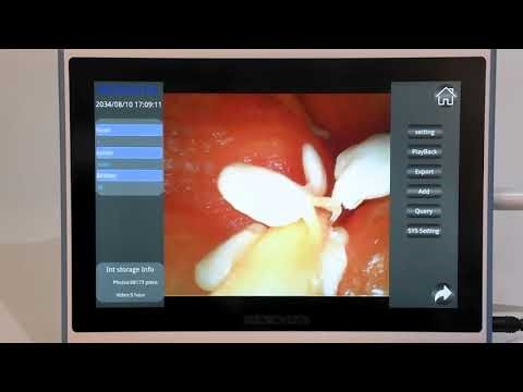 How to Use the BESDATA Disposable Bronchoscope A Step by Step Video Guide
