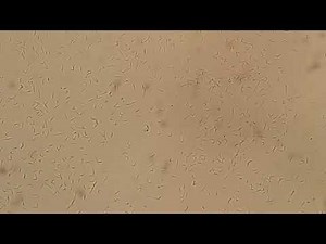 Microscopic Examination of Nocardia in Wet Mount: Morphological Features and Diagnostic Insights