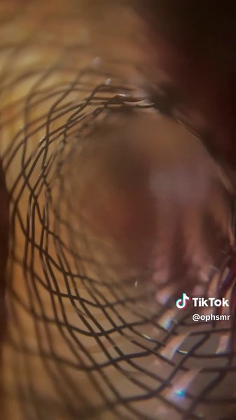 *snore* mi mi mi mi mi honestly don’t know what this is but one single person asked for it. so here it is =] #asmr #ophsmr #satisfyingsounds #tingles #asmrsounds #asmrtriggers #sleep