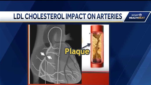 What is LDL cholesterol and how to treat it