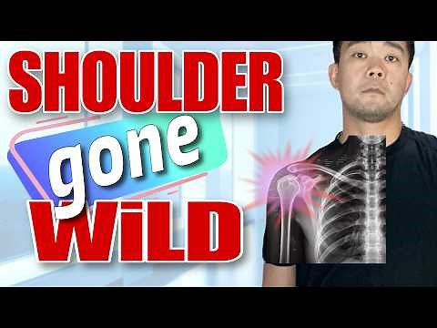 Quick Shoulder Subluxation and Dislocation Therapy Exercises