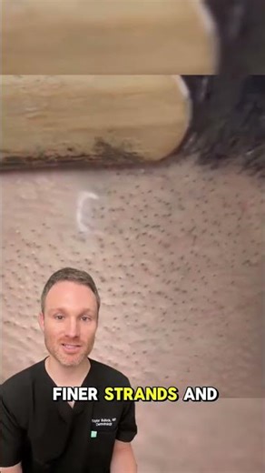 Watch as I break down how laser hair removal works—safe for most skin tones, minimal discomfort, and