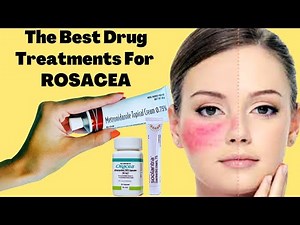 The Best Drug Treatments For ROSACEA | Rosacea Prevention Tips