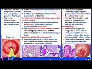 Reproductive System Pathology: Female pt.1 (Uterus & Lower uterine trac)