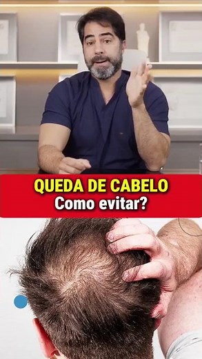 How to PREVENT HAIR LOSS NATURALLY! DISCOVER NOW