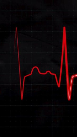 Balance Wheel — How Mechanical Watches Regulate Time | #shorts