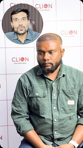 Clion Hair Transplant | +91 88662 40636 💇‍♂️ Hair transplant explained! Discover the 2 top methods—FUT & FUE. 🌱 Say goodbye to hair loss and hello to confidence.... | Instagram