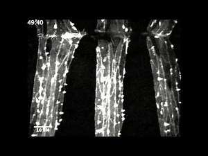 Drosophila Dorsal Closure- ASCB CellDance Winner 2012