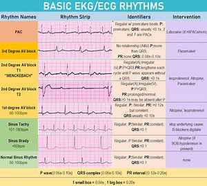 ECG Rhythms and Intervention - Etsy UK