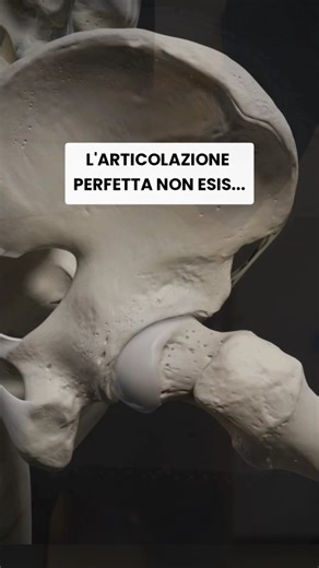 Stefano Gaudio | Fisioterapista on Instagram: "Signore e signori, sua maestà l'articolazione coxofemorale 👑 Se ci fosse un contest lei sarebbe sicuramente la candidata ideale La sua architettura è un capolavoro biomeccanico: Tipo: enartrosi (sferica) Stabilità: garantita da capsula spessa, labbro acetabolare e potentissima muscolatura circostante Mobilità su tutti i e piani dello spazio🤩: flessione, estensione, abduzione, adduzione, rotazione interna/esterna, circumduzione Funzione chiave: tra