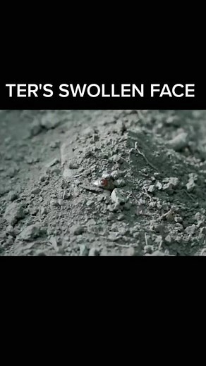 Ter's Swollen Face Scene - Pee Mak Movie
