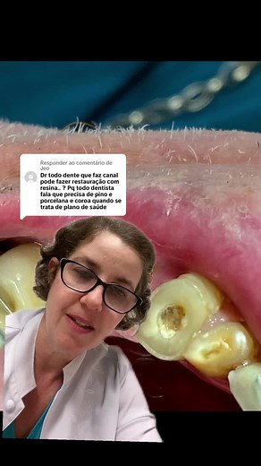 Coroa de porcelana e pino no dente com canal