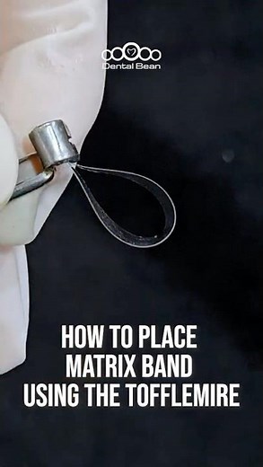 How to Place matrix band using The Tofflemire #dentalbean
