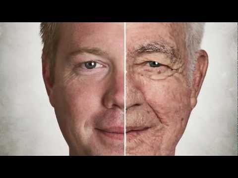 Skin Aging - What are the early signs of aging?