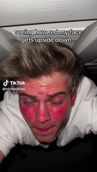 Seeing How Red My Face Gets Upside Down