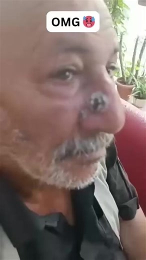 😳 It looked small, but wait till you see the ending! #drpimplepopper #grossaddiction | Pimple Popping