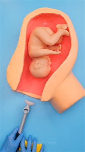 1.2M views · 5.1K reactions | Vacuum Extraction Technique 喙 | 5-Minute Crafts GIRLY | Facebook