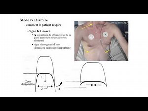 SEMIOLOGIE Signes physiques des maladies respiratoires I