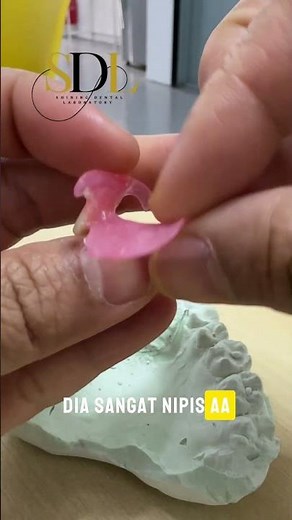 Valplast Flexible Denture. 📲More info: 01133462064 . #gigipalsu #flexibledenture #valplastdenture