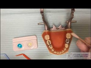 Mixing Glass Ionomer Cement