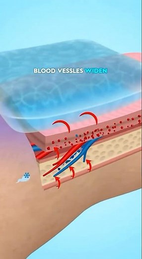 Why Ice Reduces Swelling? 🧊