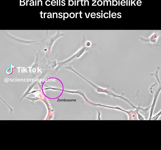 Discovering Zombosomes: Moving Brain Cell Vesicles