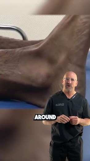 Snapping Ankle Tendon #shorts