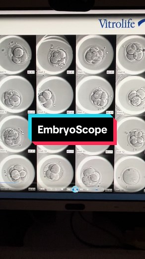 The EmbryoScope is a time-lapse culture system that allows us to monitor embryos throughout their development within a safe, undisturbed incubator environment. This is done through a built-in camera that takes photos every 10 minutes. Contact us to learn how you can get footage of your own viable embryos. #embryoscope #embryology #lab #ivf #embryoscope