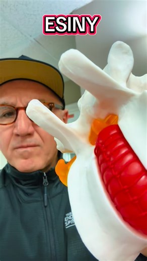 Albert Telfeian, MD | Best Spine Surgeon NYC on Instagram: "Using a spine model, I explain how traction and inversion tables create space around compressed nerves—and why that can relieve neck and arm pain or back and leg pain. Understanding the mechanism matters when choosing the right treatment. Hashtags: #SpineEducation #NeckPainRelief #SciaticaRelief #EndoscopicSpine #PatientEducation"