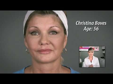 Dermawand with Creator Christina Boves