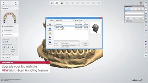 4.8K views · 57 reactions | NEW with Dental System 2018: Multi-Scan Handling. → Upgrade your lab with the new multi-scan handling feature and get the option to import multiple scans into any workflow for enhanced control and more creative freedom. | 3Shape | Facebook