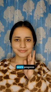 3K views · 12 reactions | What Do Women Say About SkinKraft? A lot...