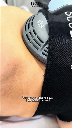 Get Abs Fast with Emsculpt Neo! Fat Reduction & Skin Tightening #bodytransformation