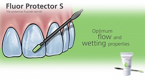 Fluor Protector S, the liquid fluoride varnish spreads easily and flows into porous surfaces. Difficult-to-reach susceptible surfaces receive the fluoride and special protection they need. #ivoclarvivadent #dentistry | Ivoclar