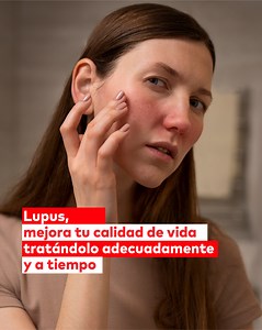 El lupus es una enfermedad silenciosa que puede pasar desapercibida. 🩺 Detectarlo a tiempo es clave para un tratamiento eficaz y una mejor calidad de vida. 💡 En Emi, te ayudamos a reconocer sus síntomas y cuidar tu salud. 📝 Descubre más sobre cómo reconocer y manejar el lupus aqui: https://bit.ly/3QP0TeM | Grupo emi
