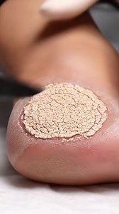 Foot ASMR Spa | Soothing Heel Scrape 4QFX . | Viral video 427