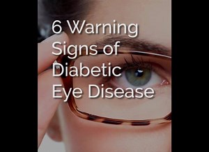 Eye disease is a serious problem… And most people don’t even realise when they have it! | Manna Health