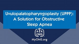 Uvulopalatopharyngoplasty (UPPP): A Solution for Obstructive Sleep Apnea
