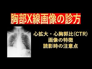 How to examine chest X-ray images - Relationship between cardiac enlargement and cardiothoracic r...