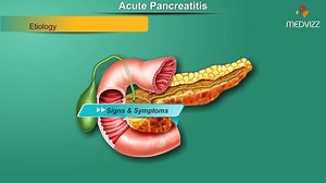 10K views · 84 reactions | Acute Pancreatitis: Etiology , signs and Symptoms, pathophysiology , Diagnosis, Treatment A sudden-onset inflammation of the pancreas that is usually associated with a history of alcohol use disorder or gallstones. Other etiologies include hypertriglyceridemia, trauma, and infection. Causes constant, severe epigastric pain that classically radiates towards the back. www.medvizz.com | Dr.G.Bhanu Prakash | Facebook