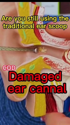 Visually digging ear spoons to clearly see the inside of the ear canal #goodthings #convenient #useful #comfortable #tools