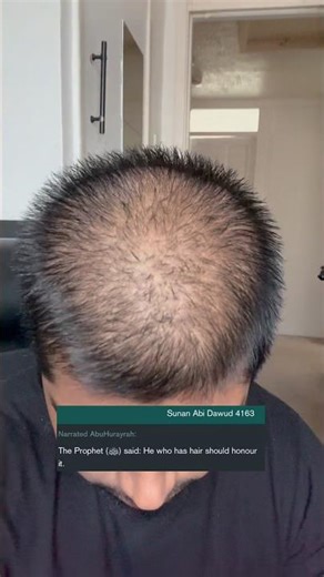 The Prophet Peace Be Upon Him Said This About Hair